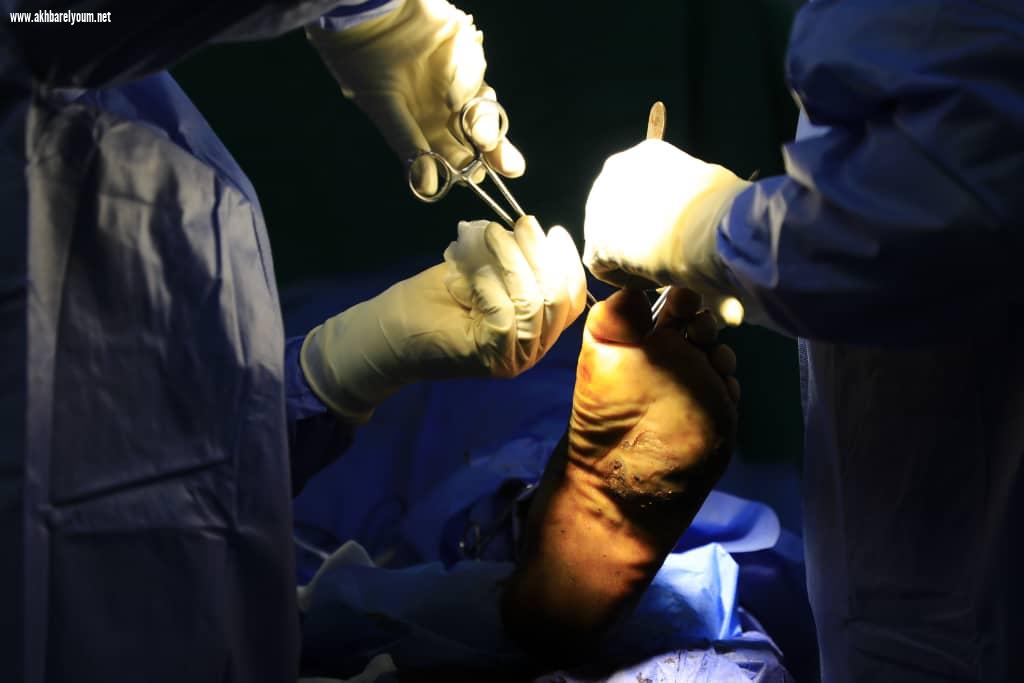  عمليات جراحية لمرضى المايستوما بالسودان بدعم من قطر الخيرية 